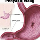Illustration for article titled Obat Maag Paling Manjurem/em